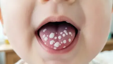 Jak se zbavit moučnivky u miminka - ilustrační foto