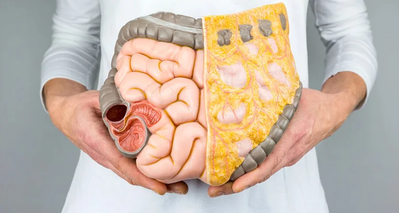 Anatomický model břicha ukazující vnitřní orgány a tukové vrstvy.