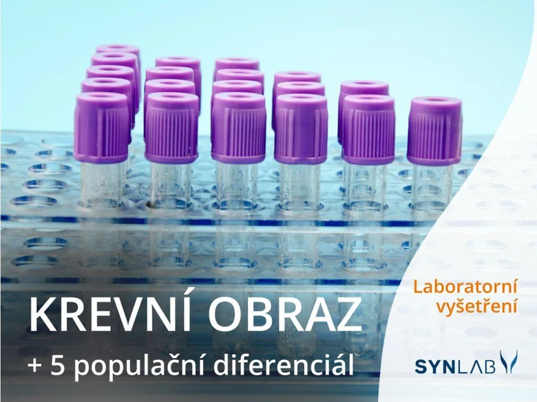 Fialové zkumavky v držáku pro krevní obraz