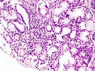 Histology slide of salivary gland