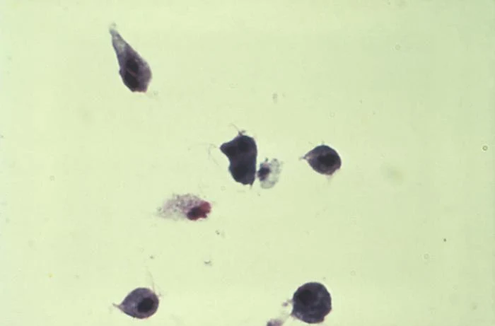 Mikroskopický pohled na buňky parazita Trichomonas vaginalis způsobujícího trichomoniázu.