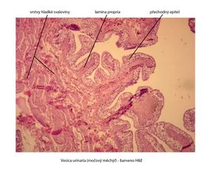 Histologický přípravek stěny močového měchýře s vrstvami sliznice a podkladem.