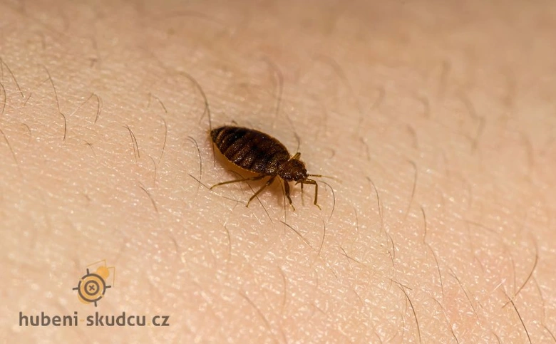 Štěnice na lidské kůži - detailní záběr pro článek o cestování.