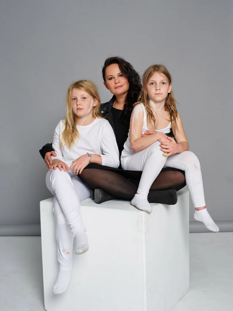 Žena s dvěma dcerami trpícími vitiligem sedí na bílém bloku.