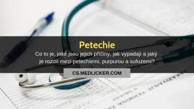 Stetoskop na dokumentu s informacemi o petechiích.