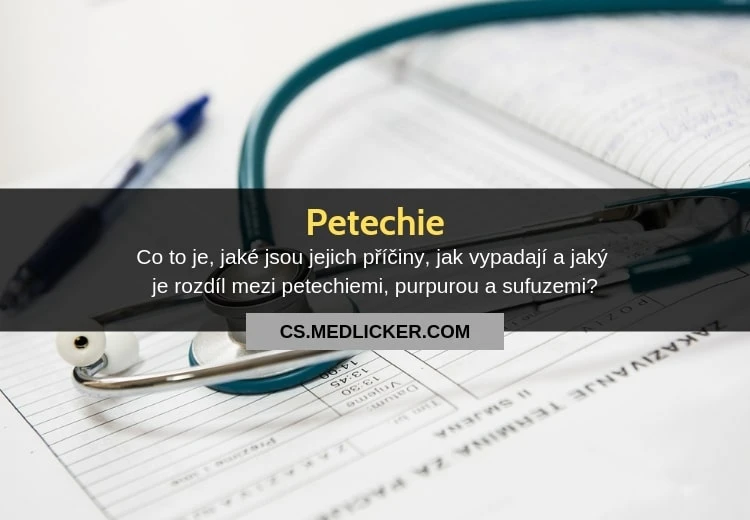 Stetoskop na dokumentu s informacemi o petechiích.