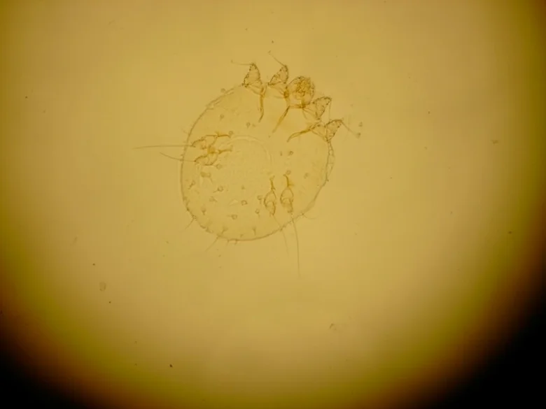 Mikroskopický pohled na svrabového klíště pro diagnostiku.