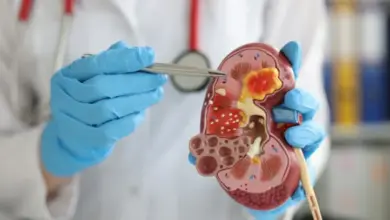 Lékař drží detailní model ledviny ukazující vnitřní strukturu.