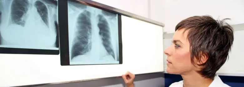 Lékařka zkoumá rentgenové snímky plic pro diagnostiku.