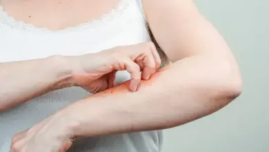 Člověk škrábe svědivé místo na paži.