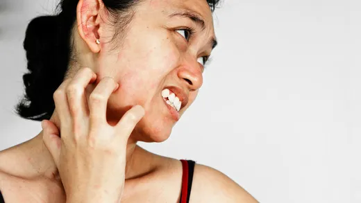 Woman with skin irritation