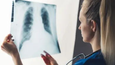 Lékařka zkoumá rentgenový snímek plic pro diagnostiku zápalu.