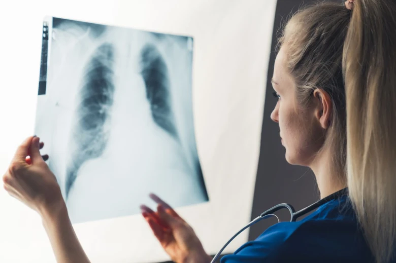 Lékařka zkoumá rentgenový snímek plic pro diagnostiku zápalu.