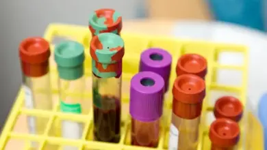 Žlutý stojan s testovacími zkumavkami na krevní odběr.