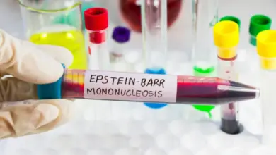 Krevní vzorek s nápisem Epstein-Barrova mononukleóza v laboratoři.