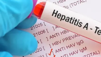 Ruka drží zkumavku s testem na hepatitidu typu A.
