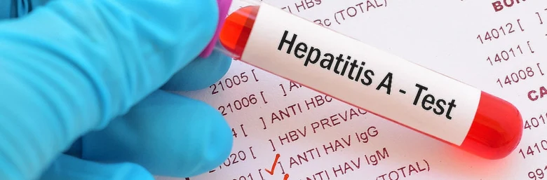 Ruka drží zkumavku s testem na hepatitidu typu A.