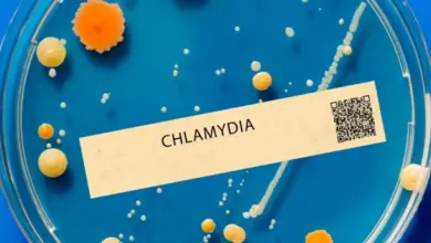 Kulturní destička s bakteriemi chlamydie na modrém podkladu.