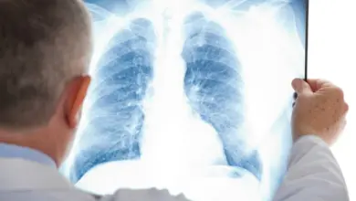 Doctor examining chest x-ray