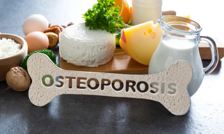 Kostní tvar s nápisem osteoporóza obklopený mlékem, sýrem a vejci.
