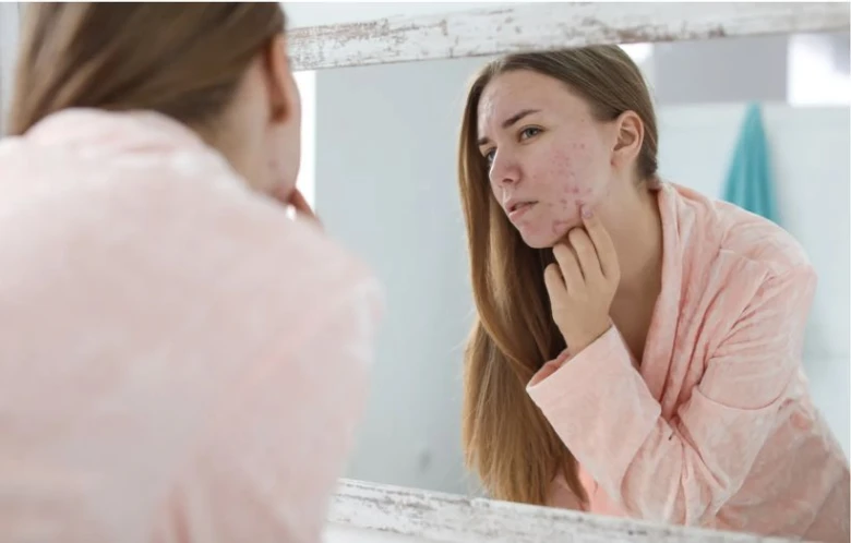Žena se dívá do zrcadla na svá akné v koupelně.