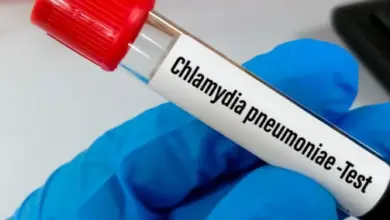 Ruka v modrých rukavicích drží zkumavku s chlamydií pneumonie.