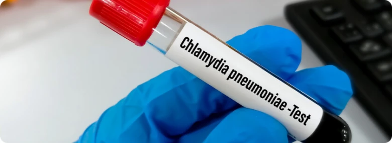 Ruka v modrých rukavicích drží zkumavku s chlamydií pneumonie.
