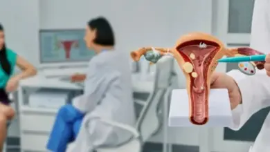 Model dělohy s cystami ukazuje příznaky endometriózy.