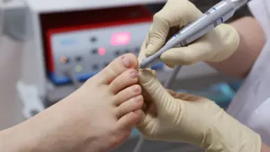 Léčení kuří oka na noze pomocí elektrického pilníku.