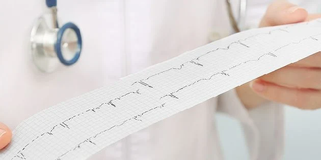 Lékař drží EKG papír s kardiálním rytmem uvnitru.