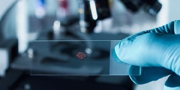 Ruka drží mikroskopický preparát s buňkou v laboratoři.