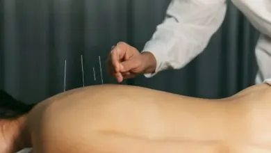 Akupunktura na zádech při léčbě fibromyalgie.